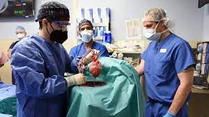Primer trasplante exitoso de riñón de cerdo a persona viva