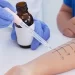 Vacunas para alergias: un enfoque en aumento para combatir los síntomas desde la raíz y prevenir complicaciones