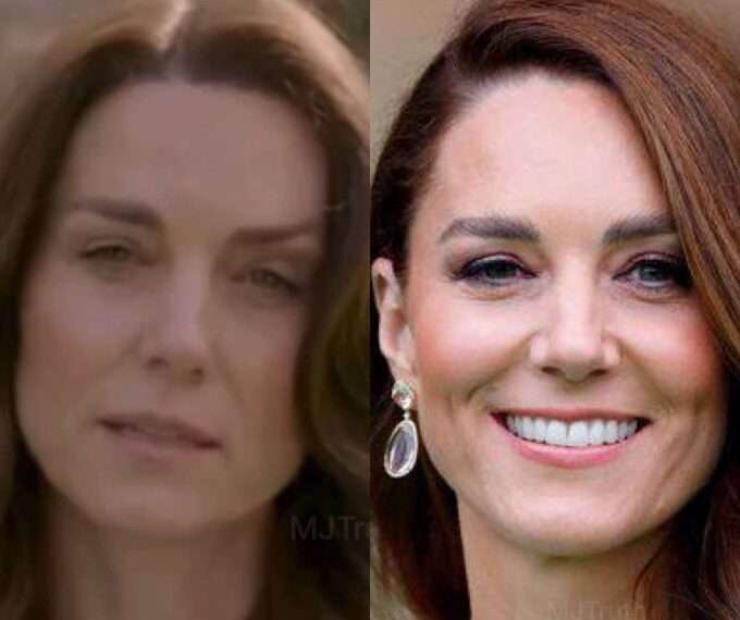 Kate Middleton: Estado de Salud y Perspectivas Laborales
