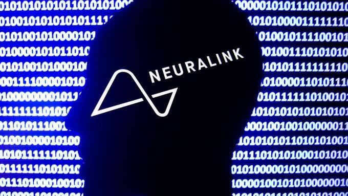 Neuralink busca voluntarios para prueba de dispositivo cerebral