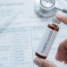 La tuberculosis se convierte nuevamente en la enfermedad infecciosa más mortal