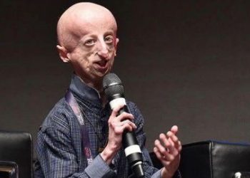 Sammy Basso, el científico italiano que visibilizó la progeria, muere a los 28 años