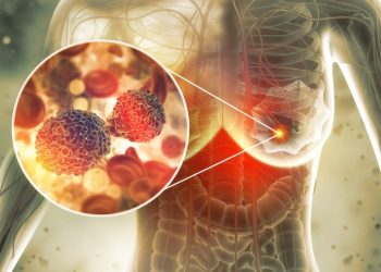 Google presenta su IA para detectar cáncer de mama: Acceso gratuito disponible