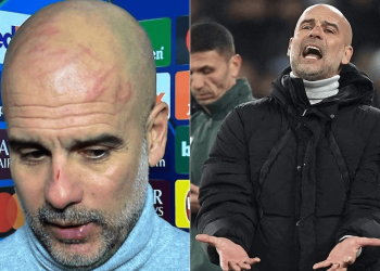 Pep Guardiola aclara los rasguños en su rostro: “Hay que buscar ayuda”