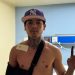 Natanael Cano actualiza sobre su salud tras sufrir accidente