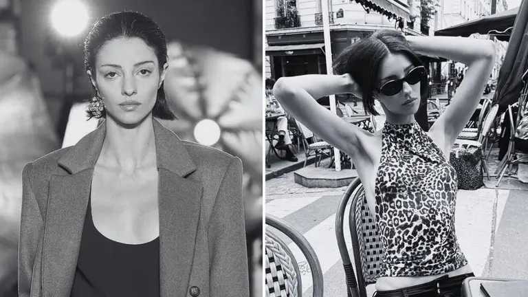 La modelo australiana Lucy Markovic falleció a los 27 años luego de luchar contra una malformación arteriovenosa cerebral.