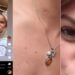 Valentina Gilabert revela sus cicatrices tras brutal agresión