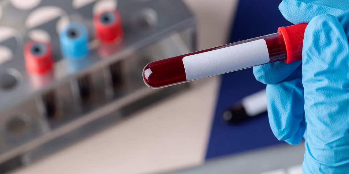 Japón inicia pruebas en humanos con sangre artificial universal