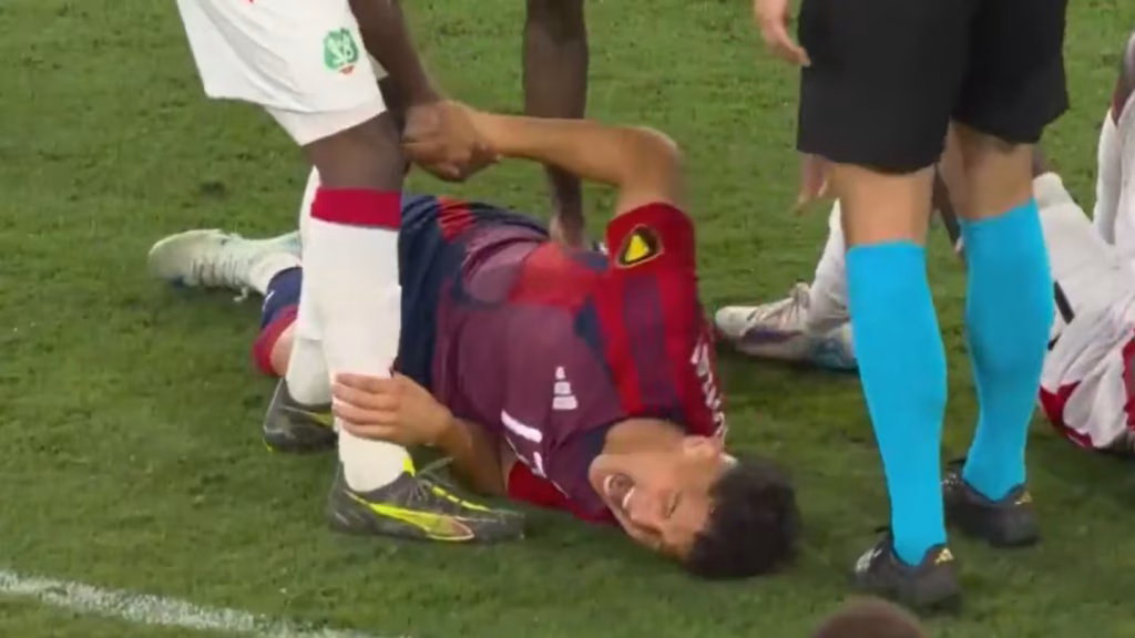 El delantero costarricense Warren Madrigal sufrió una fractura de peroné en el duelo ante Surinam, quedando fuera de la Copa Oro 2025. La Selección Mexicana podría beneficiarse ante una Costa Rica sin su principal atacante.